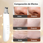 Limpiador Facial PUNTOS NEGROS