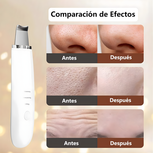 Limpiador Facial PUNTOS NEGROS